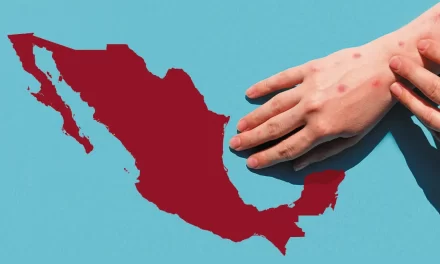 El regreso del sarampión, gracias a AMLO